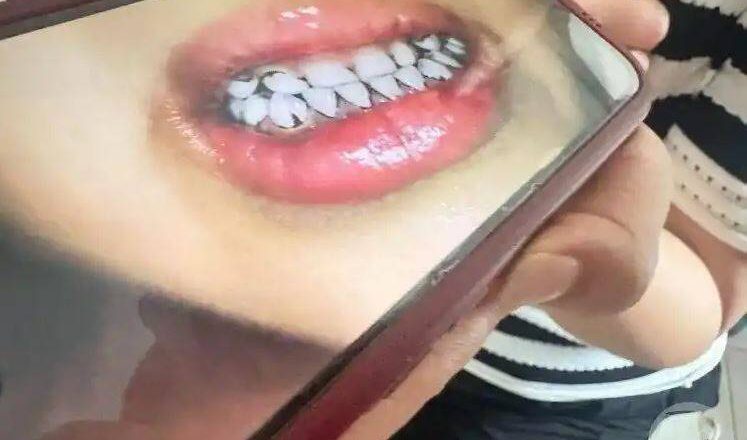 夭寿！中国幼儿园233童铅中毒 竟是园长指示用颜料制作餐点